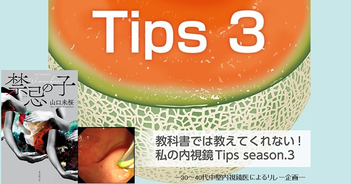 Tips 298 膵管ガイド、困ったときにはサイド法～右がダメなら左から　山口 未桜（作家、医師資格として日本消化器内視鏡学会専門医、日本膵臓学会認定指導医など)